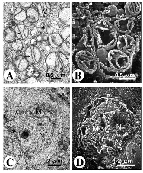 Spermatogonia Tem A And Sem B Micrographs Of The Primary