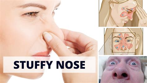 How To Cure Stuffy Nose 6 Home Remedies For Stuffy Nose Youtube