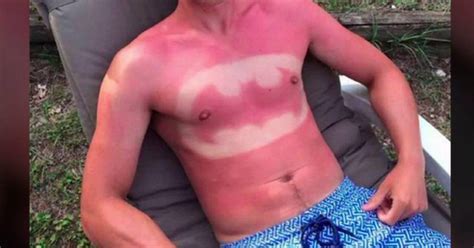 Or will you be sent back to late model cars and learn how to compete with the best. Bad Cases Of Sunburn | PHOTOS - WCCB Charlotte's CW