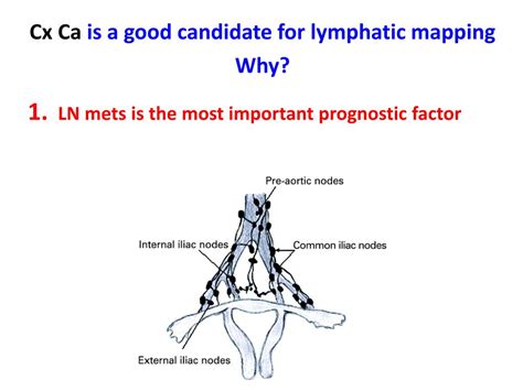 Ppt Sentinel Lymph Node Sln In Cervical Cancer Cx Ca Powerpoint