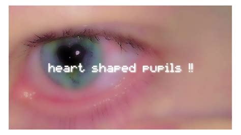 Heart Shaped Pupils Youtube