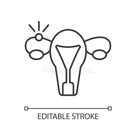 ectopic pregnancy stock illustration illustration of pregnant 92082133