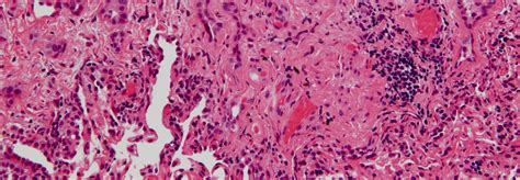Maybe you would like to learn more about one of these? Hawaii Mesothelioma and Asbestos Attorneys- Galiher ...