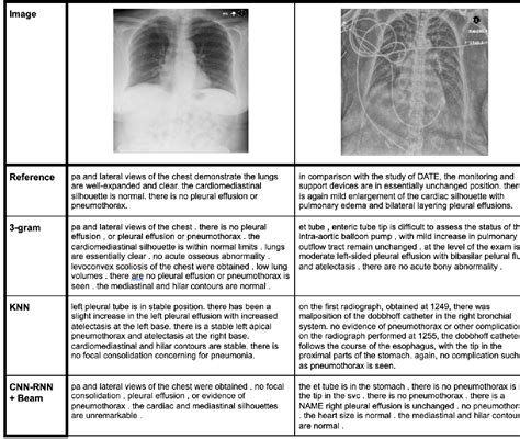 Pdf Baselines For Chest X Ray Report Generation Semantic Scholar