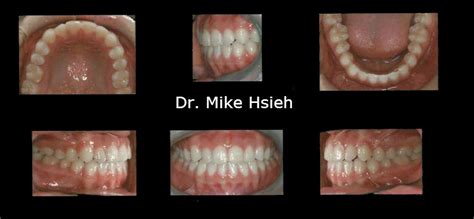 Orthodontic Cases 98271 Dentist 98270 Dentist