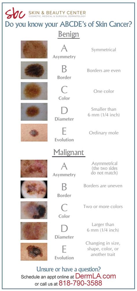 Know Your Abc S Of Skin Cancer
