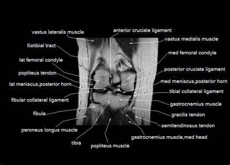 Knee Muscle Anatomy Mri Knee Anatomy Mri Driverlayer Search Engine