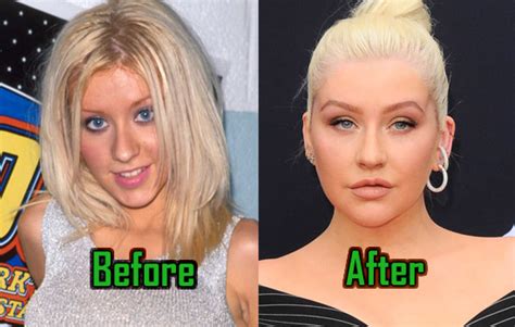 Christina Aguilera Plastic Surgery Did She Really Have It Before