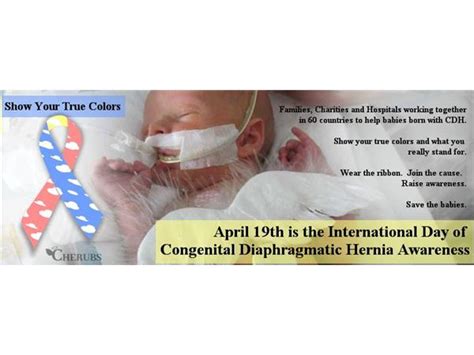 Congenital Diaphragmatic Hernia Awareness 0414 By Cdh Radio Hosted By