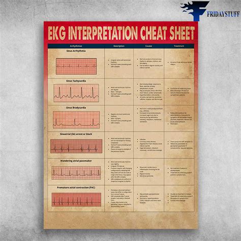 Ekg Interpretation Cheat Sheet Heart Arrhythmias Sinus Arrhythmia