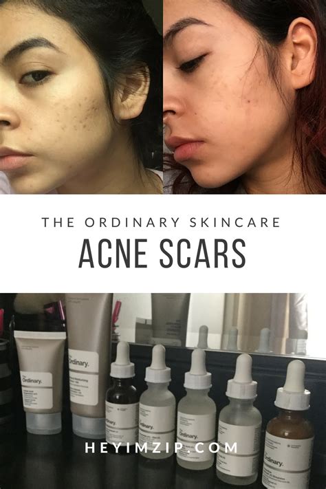 The ordinary skin care regimen. Pin on Marizip