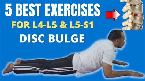 Best Exercises For L4 L5 L5 S1 Disc Bulge 95 Relief Treatment Low