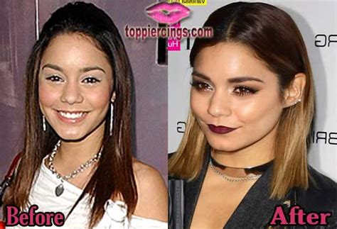 Vanessa Hudgens Nose Job Before And After Photos Top Piercings