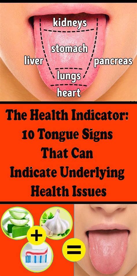 The Health Indicator 10 Tongue Signs That Can Indicate Underlying Health Issues Health