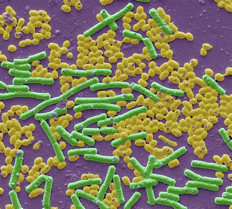 Haemolytic Streptococcus And E Coli Photograph By Steve Gschmeissner