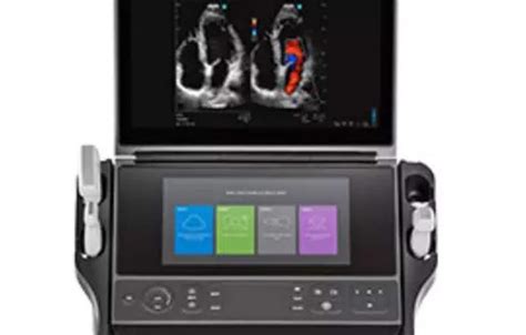 Fujifilm Sonosite Launches New Point Of Care Ultrasound System In India