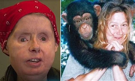 Chimpanzee Travis Victim Charla Nashs Body Rejecting Face Transplant