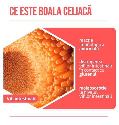 Boala Celiac Intoleran A La Gluten Medic Chat