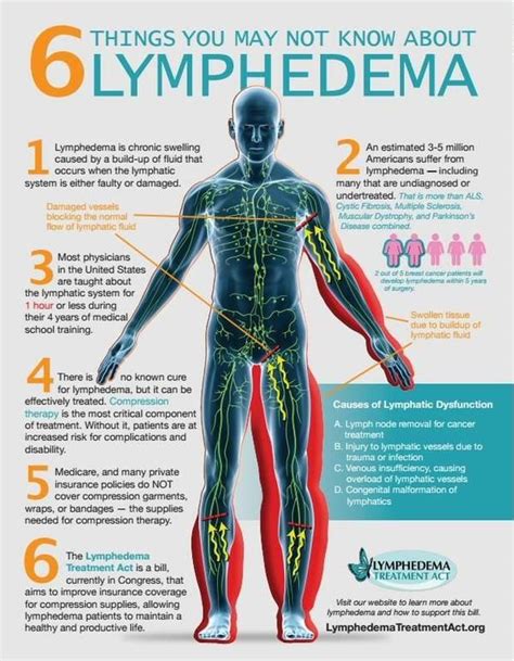 Lymphedema Lymphsystem Lymph Swelling Longwellmassagetherapy