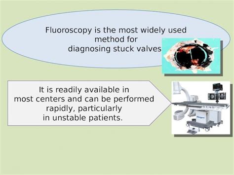 Role Of Cinefluoroscopy In Prosthetic Valve Disease Pptx Powerpoint