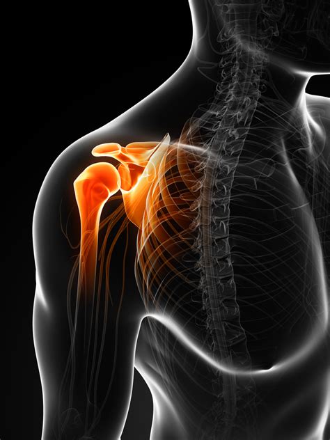 Frozen Shoulder Causes And Treatment Myhealth Bytes