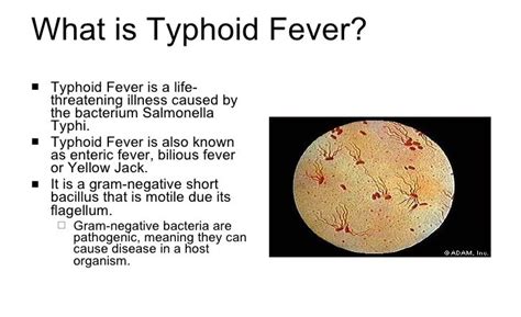 Typhoid Fever What You Need To Know Insurance Chat