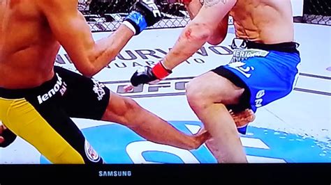 We did not find results for: Anderson Silva broken leg.UFC 168 - YouTube