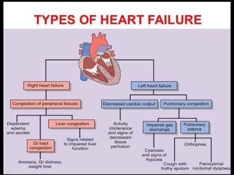 Heart Failure Classification