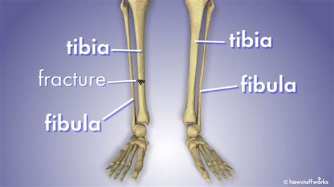 Whats The Difference Between The Fibula And Tibia Howstuffworks
