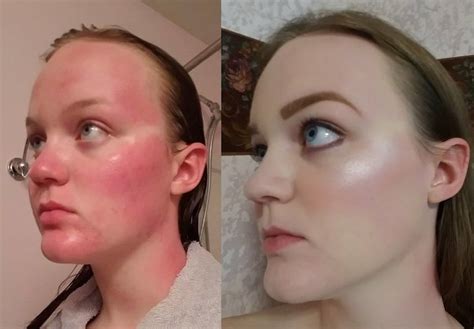 People Are Freaking Out Over This Foundation Before And After Photo