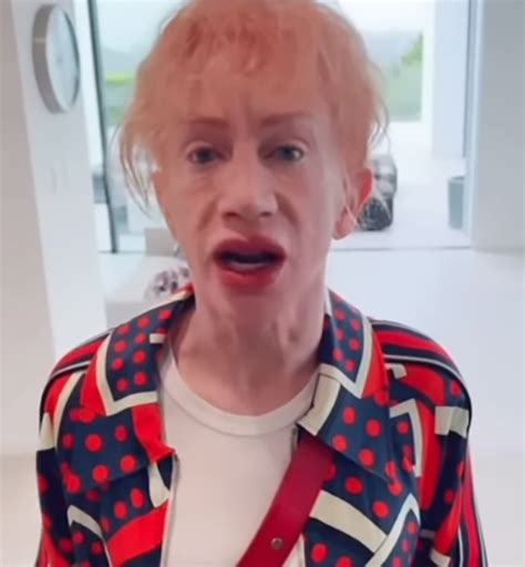 Kathy Griffin Shocks Fans With Dramatically Swollen Lips After Tattoo Procedure It’s ‘giving