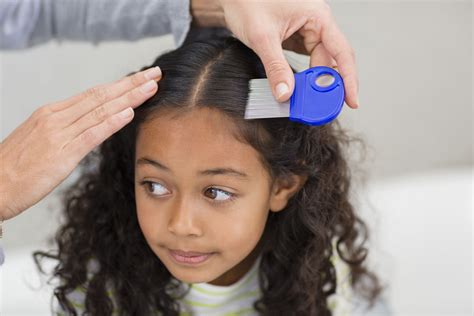 How To Get Rid Of Nits And Head Lice Bathmost9