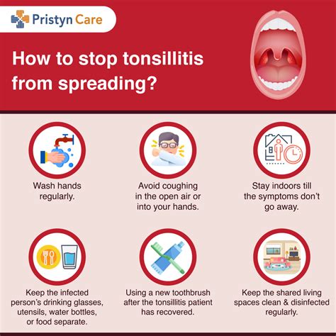 Is Tonsillitis Contagious Pristyn Care