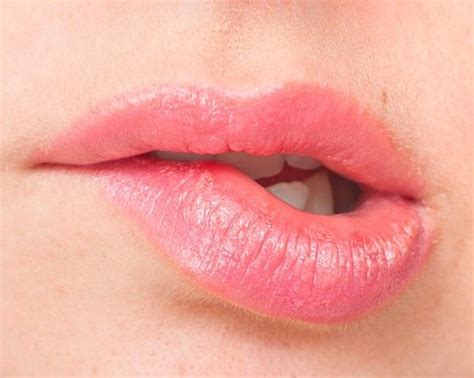 The Best Way To Soothe Sunburned Lips Sunburned Lips Sunburnt Lips