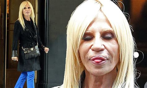 Donatella Versace Shows Off Dramatically Fuller Lips As She Steps Out