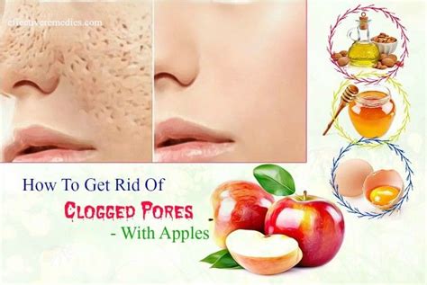 9 Best Ways To Say Goodbye To Clogged Pores On Face Nose Chin And Eyes