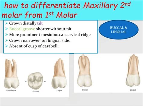 Tooth Morphologythe Architecture Of Part 3premolar And Molar