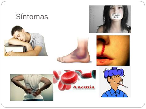 Ppt Leucemia Powerpoint Presentation Free Download Id2058120