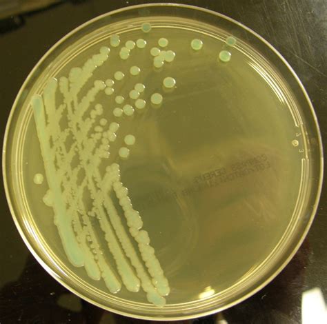 Bacillus Cereus Junglekeyfr Wiki