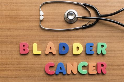 Bladder Cancer Prevention Tips And Treatments