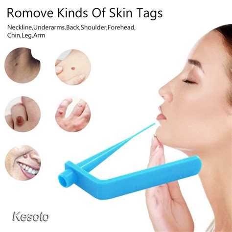 [kesoto] skin tag killer adult skin mole wart remover band skin tag removal kit with cleaning