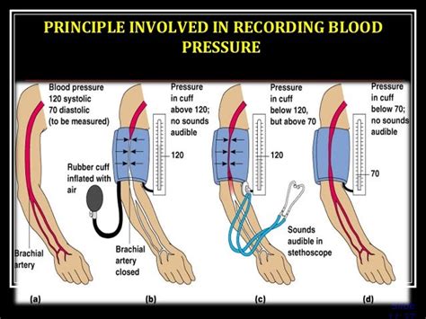 Arm Position Blood Pressure Diagram General Wiring Diagram