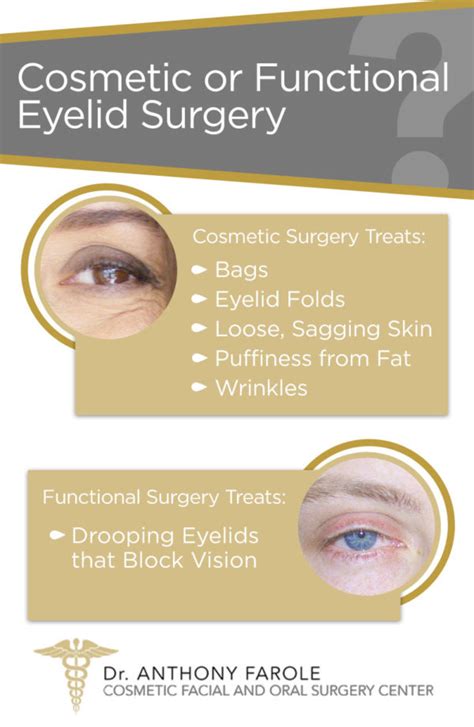 Do I Need Eyelid Surgery Dr Anthony Farole Dmd Facial And Oral