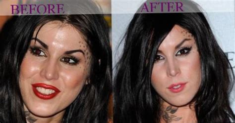 Book your cosmetic surgery now: Celebrity Kat Von D - plastic surgery, photos, video