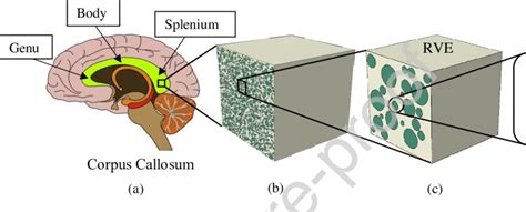 A Corpus Callosum Of The Human Brain And Its Three Major Regions