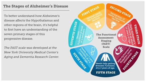 Alzheimers Disease What We Know And What We Can Expect From The