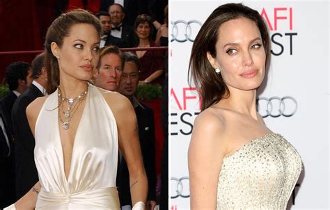 Stars Who Have Gotten Breast Implants Before After Plastic Surgery