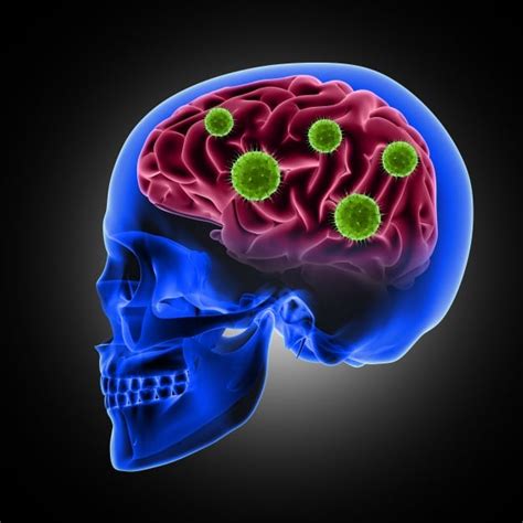 Brain Health Viruses And The Therapeutic Action Of Herbs