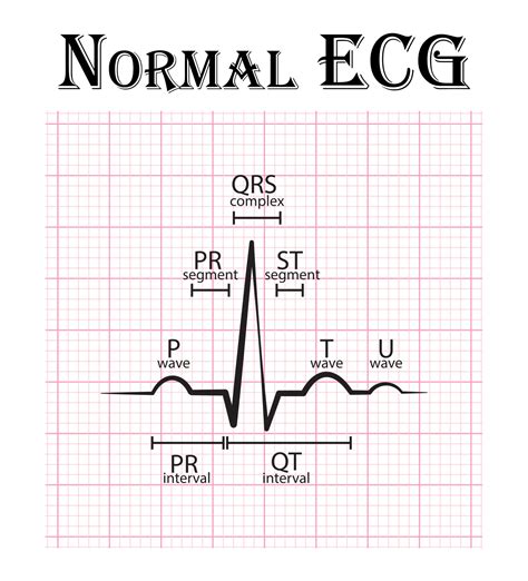 Normal Ecg Electrocardiogram Chart 2268232 Vector Art At Vecteezy