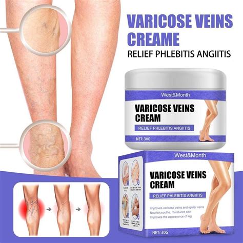 5pcs Varicose Veins Ointment Relieve Thigh Blood Vessels Swelling